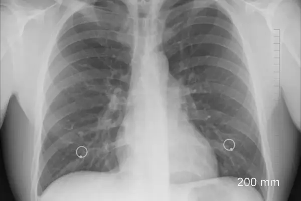 mi a pulmonológia